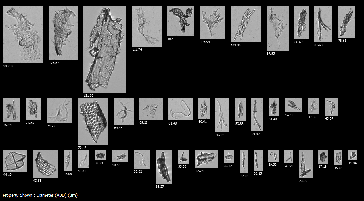 FlowCam images of particles that might indicate a malfunction of the injection molding process in single use technologies