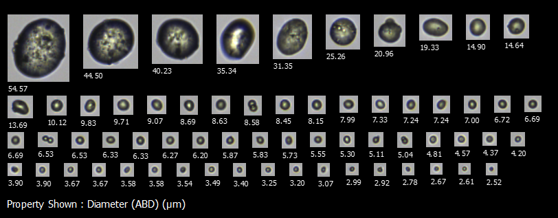 FlowCam images of particles that might indicate abrasion in single use technologies