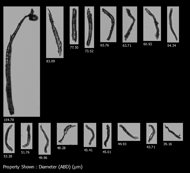 FlowCam images of particles that might indicate a malfunction of cutting tools in single use technologies