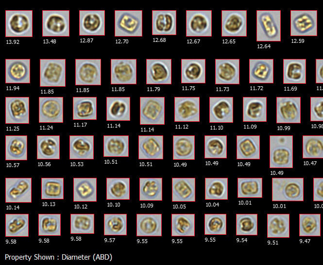 Shell Fish Mri Shellfish Aquaculture Monitoring | Bivalve Research | FlowCam