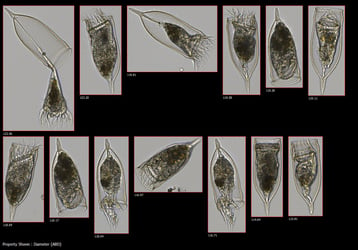 FlowCam collage of Tinnitids zooplankton