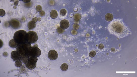tumoroids-microscopy