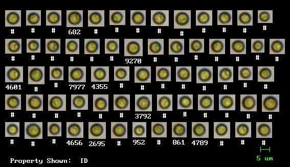 Morphological Algae Analysis Using Dynamic Imaging Particle Analysis