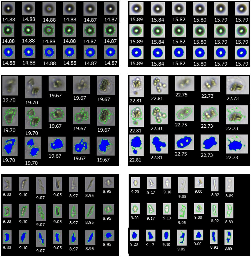 FlowCam images showing the effect of various background intensity settings