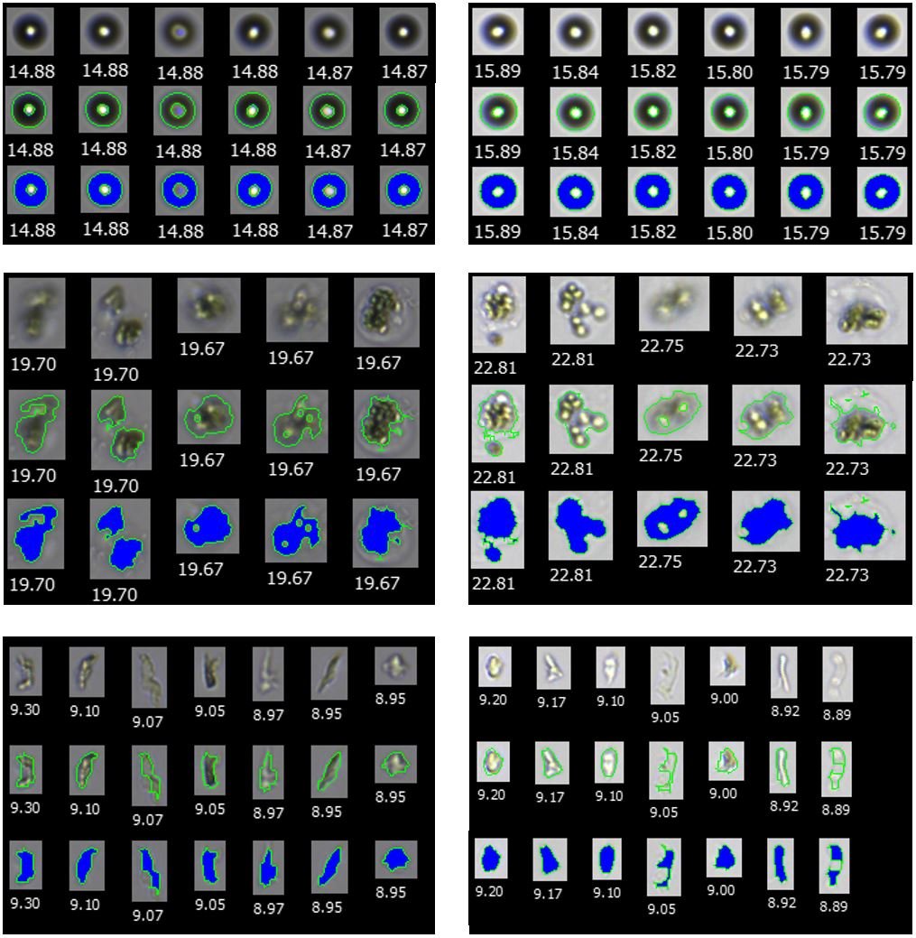 The Effect of Background Intensity Settings on Particle Image Analysis Results