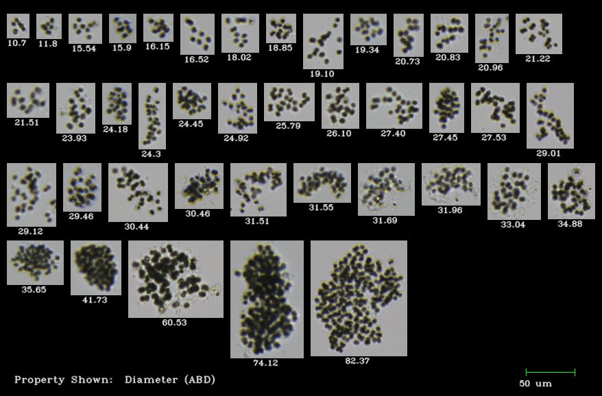 Answering Your FAQs about Analyzing Microcystis with FlowCam