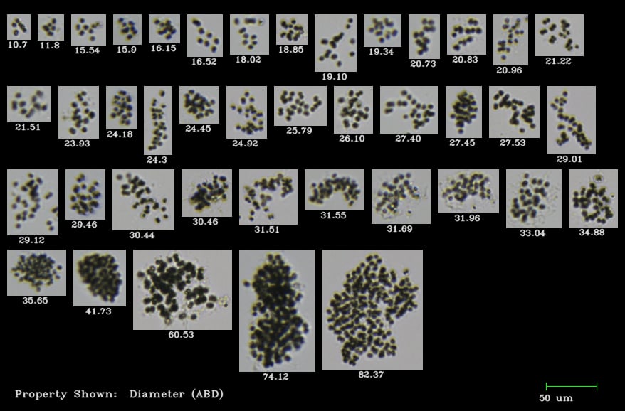 Answering Your FAQs about Analyzing Microcystis with the FlowCam