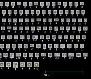 Algae Viability Analysis with FlowCam: Effect of Continuous Flow Electrocoagulation Flocculation