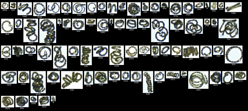 FlowCam collage of Anabaena HABs