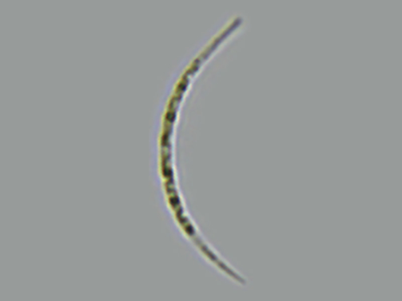 Ankistrodesmus falcatus var. mirabalis sp.