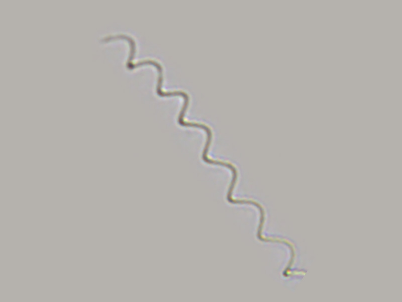 Arthrospira sp.