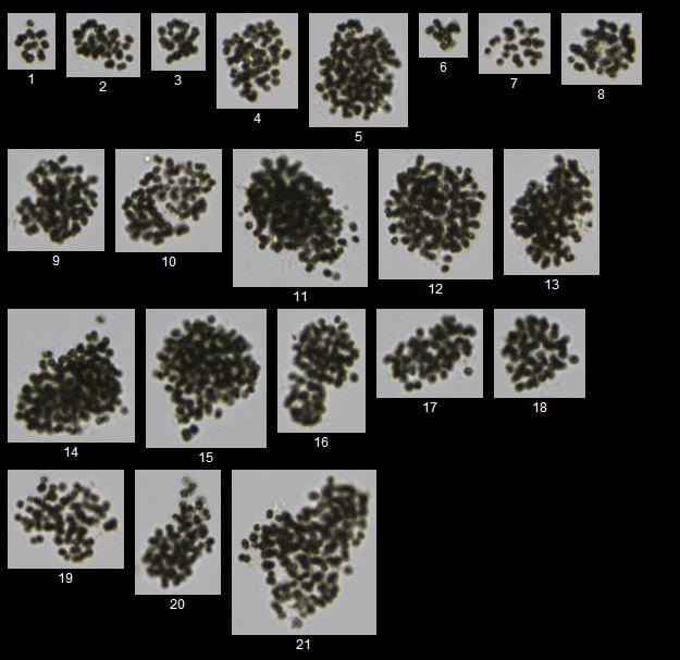 New Method for Cell Counting Microcystis Colonies Using Image Processing Method