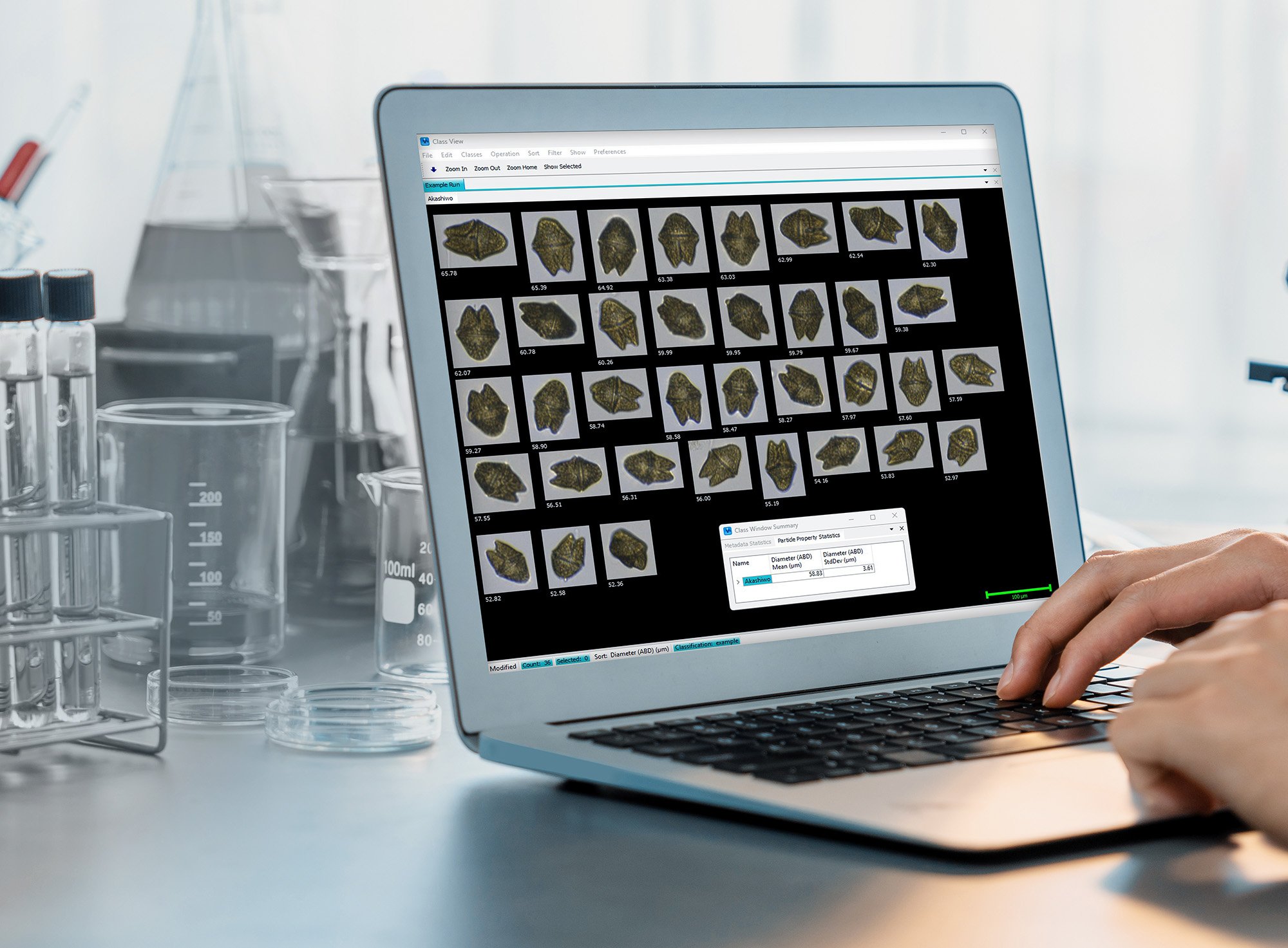 FlowCam for Particle Analysis & Semi-Automated Classification