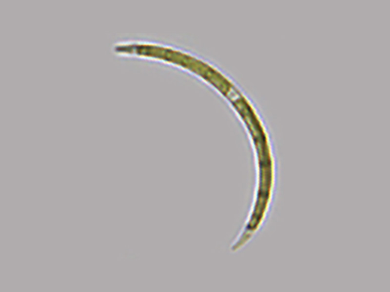 Closteriopsis sp.