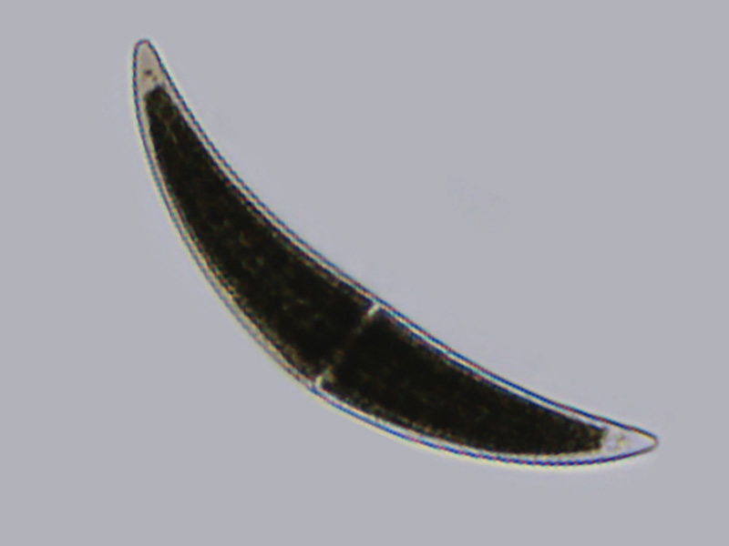 Closterium sp.