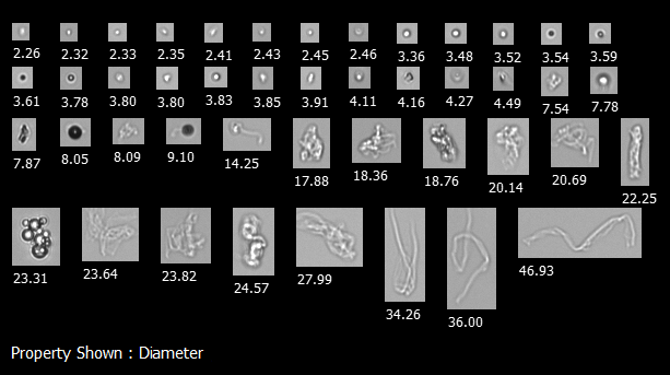 FlowCam collage of particles in a biopharmaceutical formulation