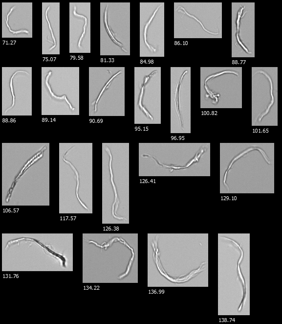 Revolutionizing Fiber Characterization with FlowCam