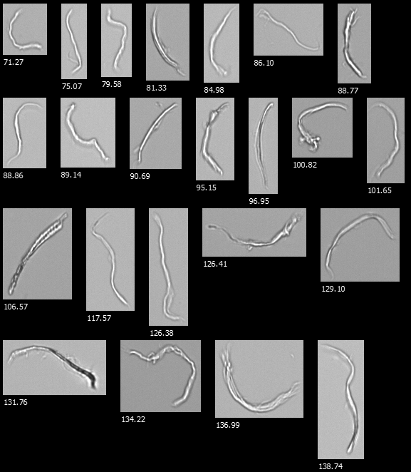 Fiber Analysis with Flow Imaging Microscopy