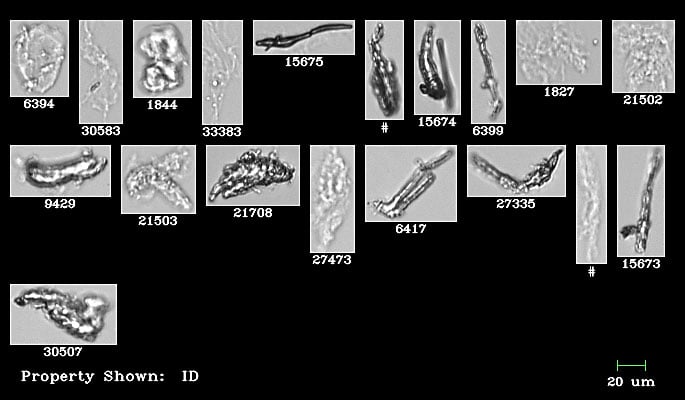 FlowCam collage of protein aggregates