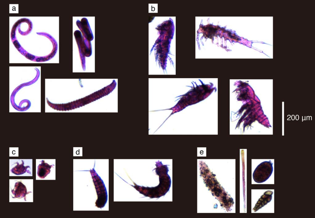 New Method for Meiobenthos Analysis Using FlowCam