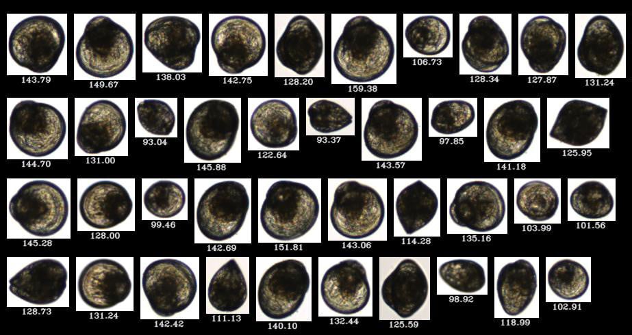 FlowCam collage of oyster larvae