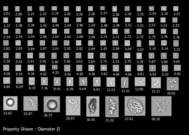 A biopharmaceutical sample imaged on FlowCam 8100 containing silicone oil droplets, protein aggregates, and polysorbate particles