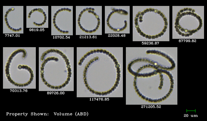FlowCam collage of Dolichospermum cyanobacteria