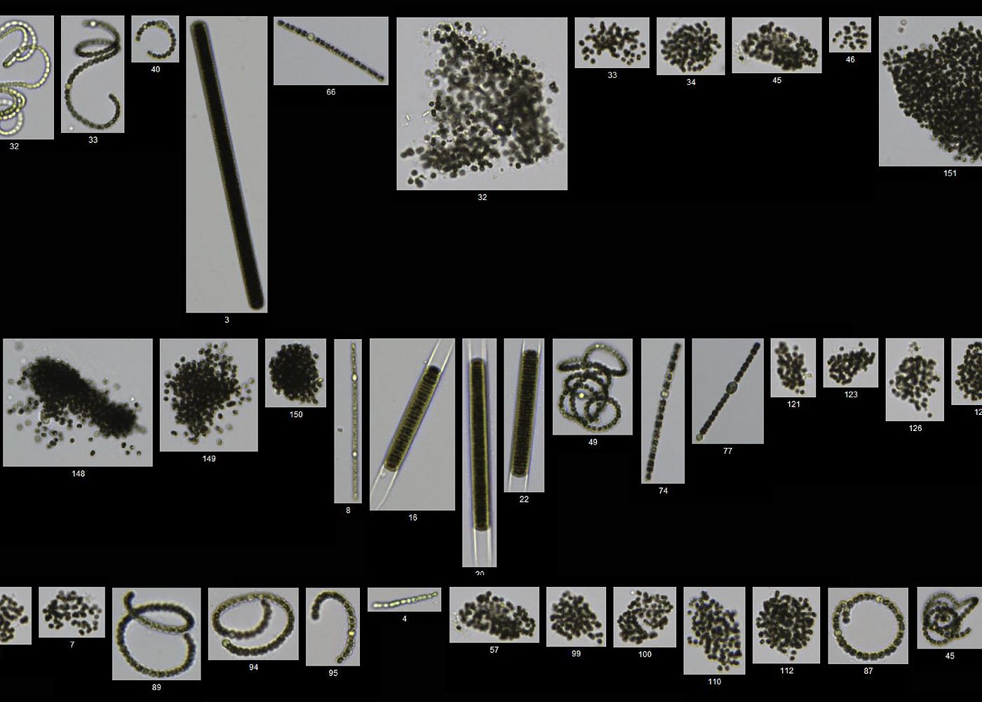 A FlowCam Cyano collage containing cyanobacteria: Microcystis, Dolichospermum (Anabaena), Lyngbya