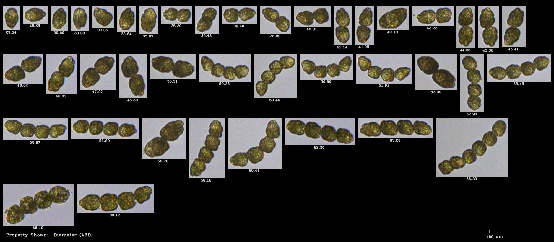 FlowCam collage of harmful algae