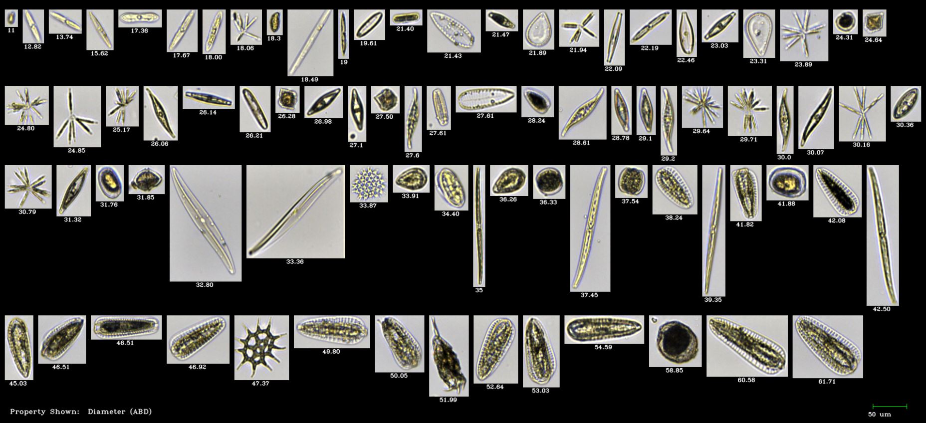 A FlowCam Cyano collage of plankton species captured in the Anacosta River, Washington, D.C.