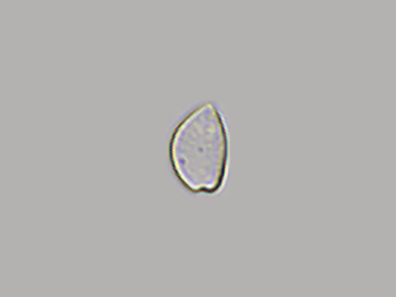 Prorocentrum micans