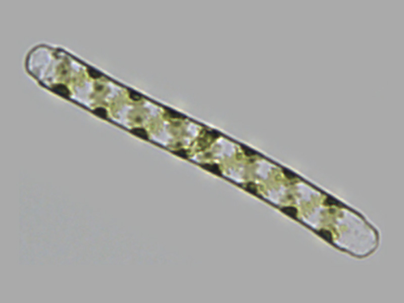 Spirogyra sp.
