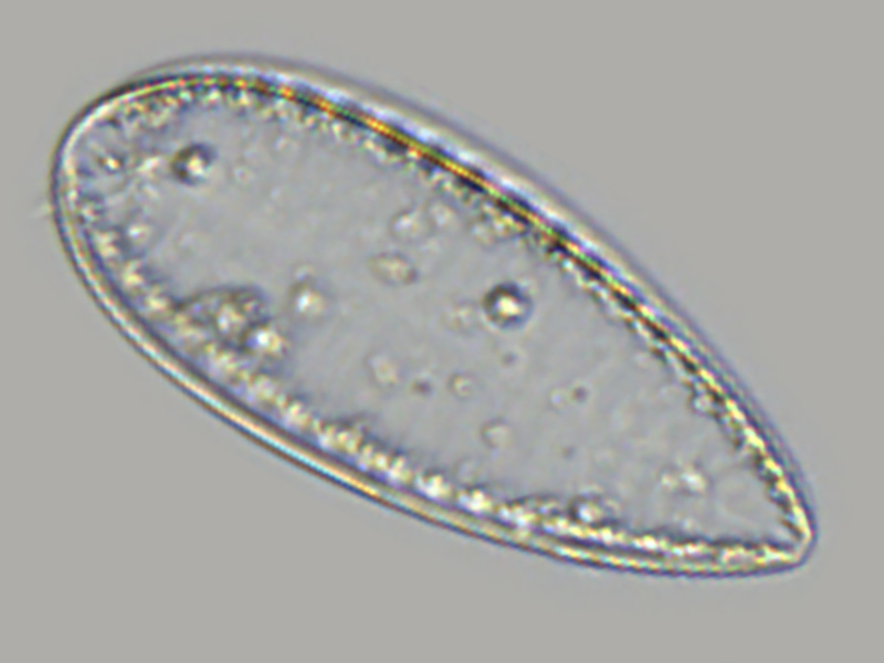 Suriella sp.